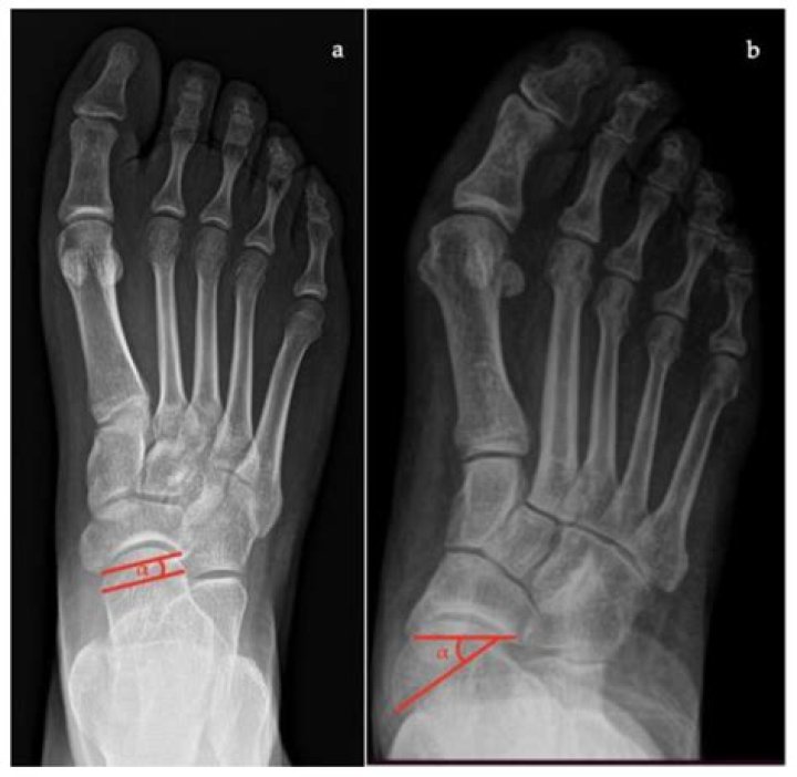 Arizona Zervas's Impressive Height: Uncovering The Details