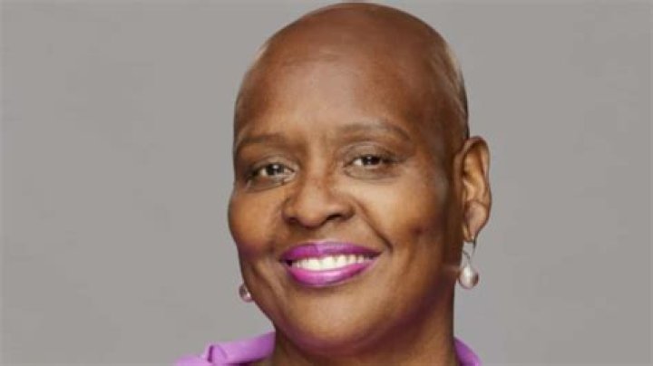 Felicia Of Big Brother Opens Up About Hair Loss Journey