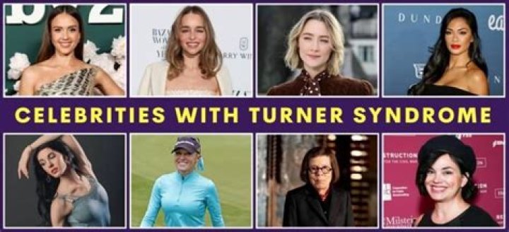 Inspiring Lives: Turner Syndrome Celebrities Who Redefine Beauty