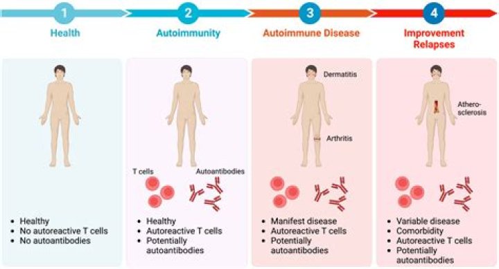 The Ultimate Guide To RADamm: Understanding And Treating This Autoimmune Disease