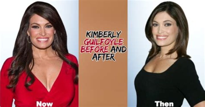Transformational Journey: Kimberly Guilfoyle Before And After
