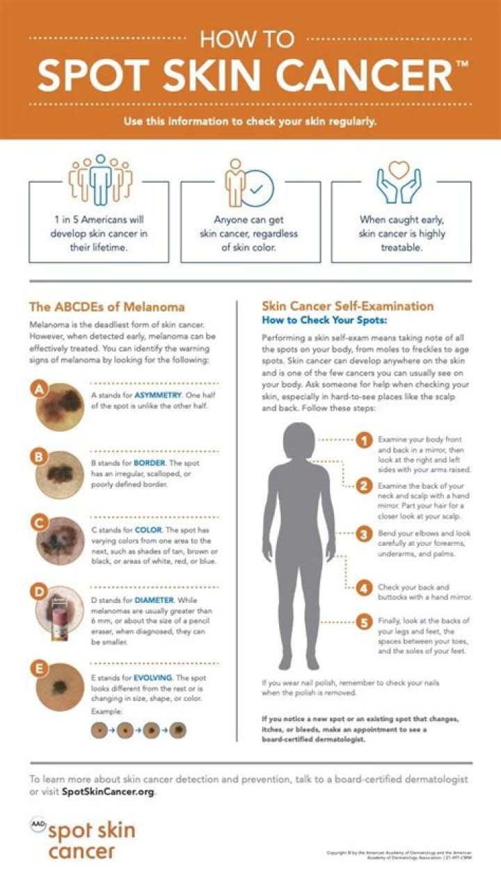 Understanding Melanoma: A Comprehensive Guide To Skin Cancer