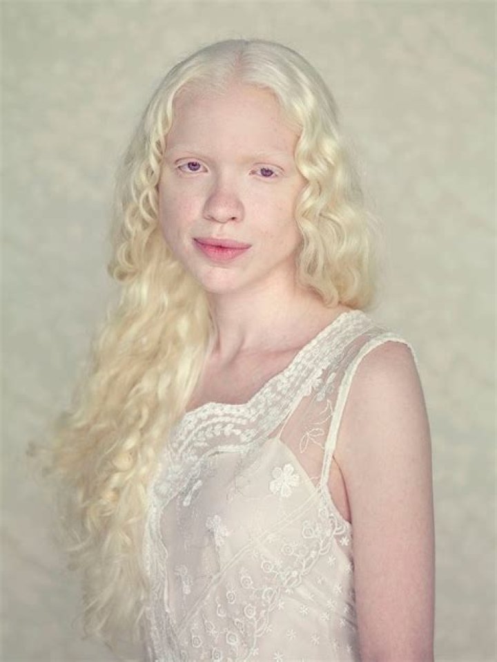 Understanding The Unique Beauty Of Ginger Albino