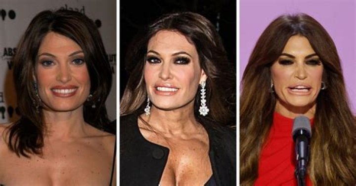 Unveiling The Remarkable Kimberly Guilfoyle Transformation