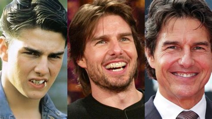 Unveiling The Secrets Behind Tom Cruise's Teeth