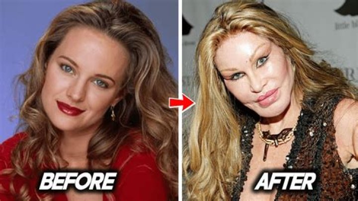 Unveiling The Truth: Did Sharon On Young And Restless Have Plastic Surgery Today?