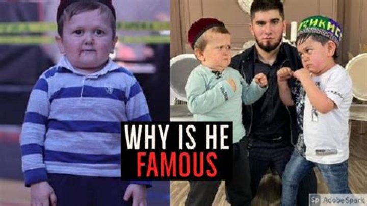 What Health Condition Does Hasbulla Magomedov Have? - Hidden Truth Revealed
