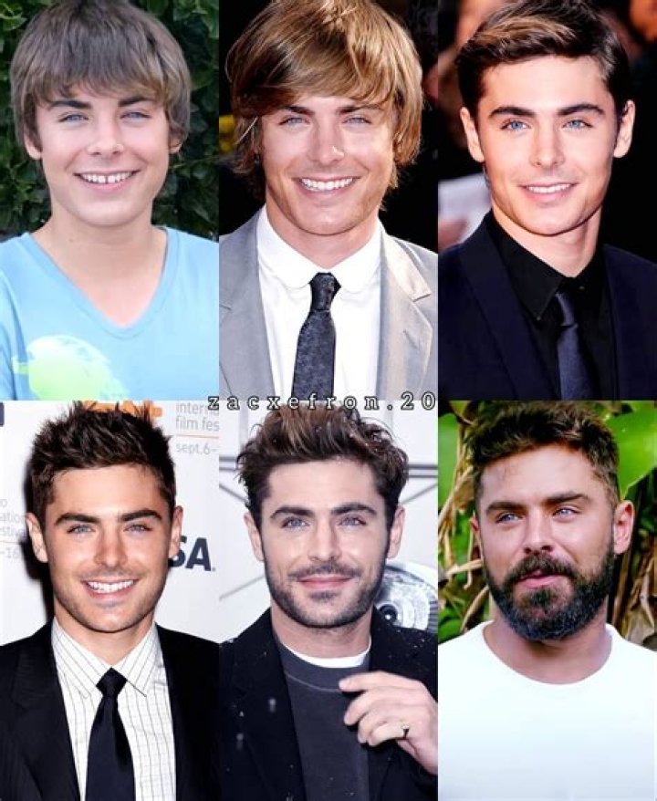 Zac Efron Age: The Evolution Of A Star